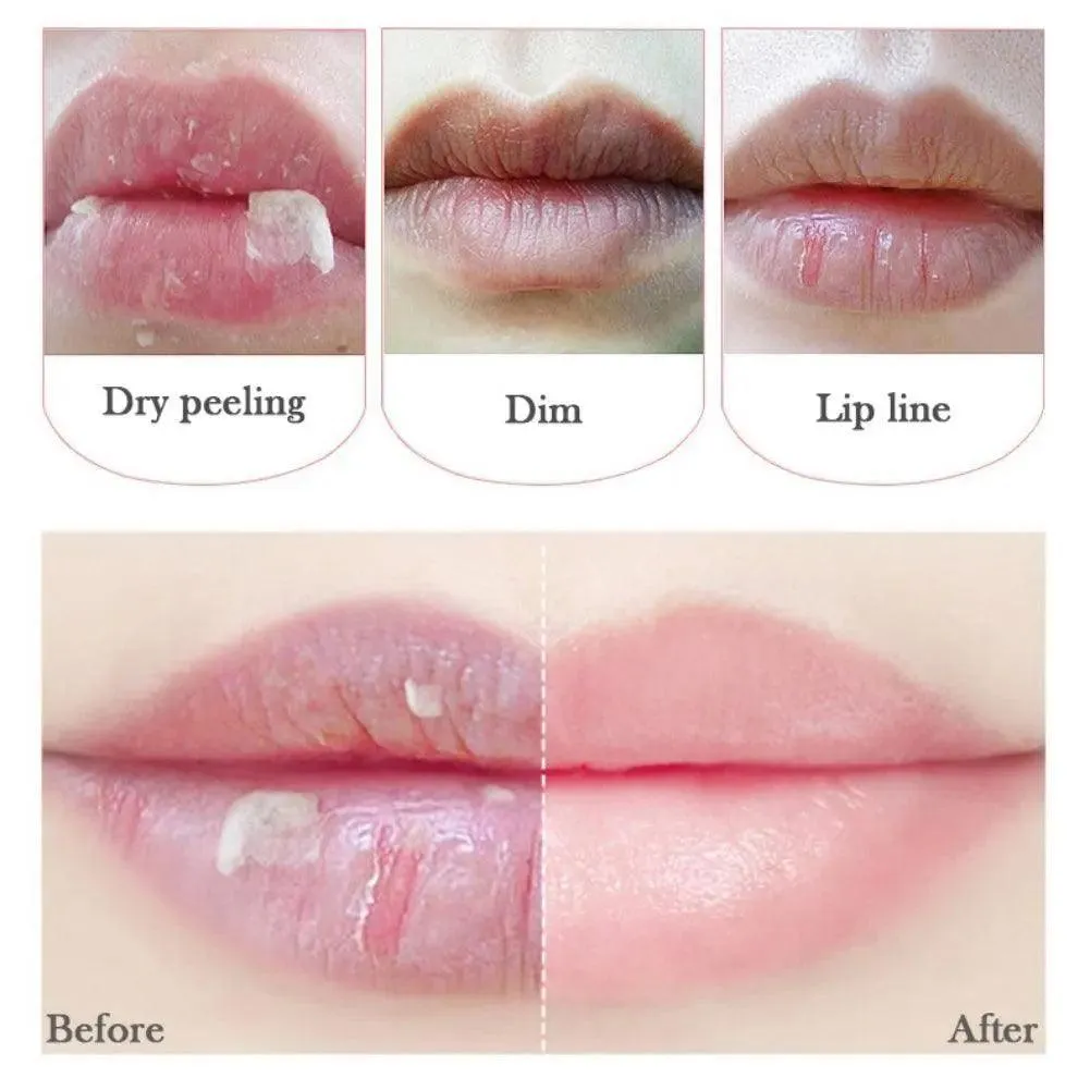 Lip Care Set Gel and  Mask